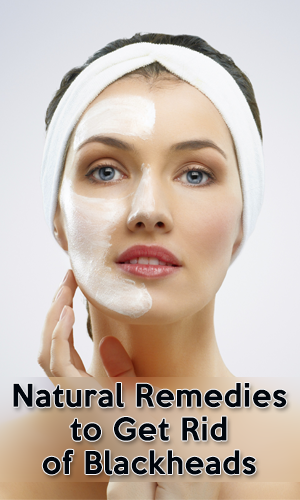 Natural Remedies to Get Rid of Blackheads